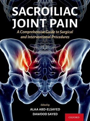 cover image of Sacroiliac Joint Pain